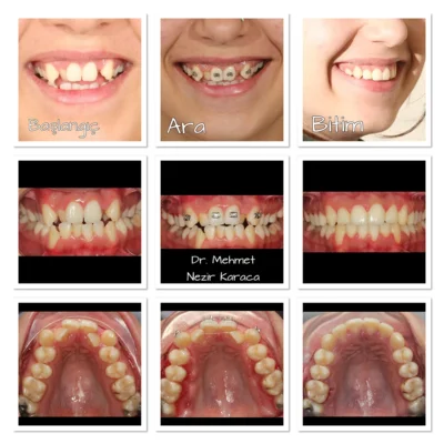 vakalarımız - mutlu gülüş galerisi