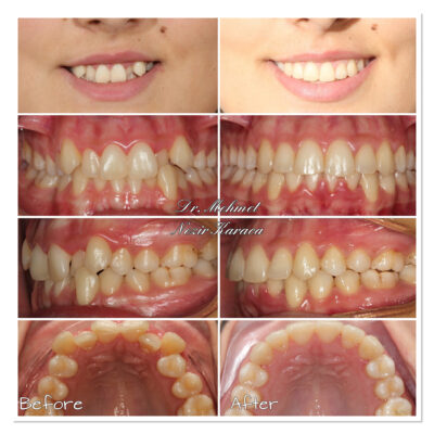 vakalarımız - mutlu gülüş galerisi