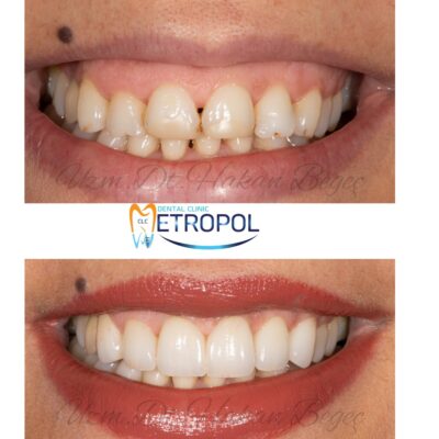 vakalarımız - mutlu gülüş galerisi