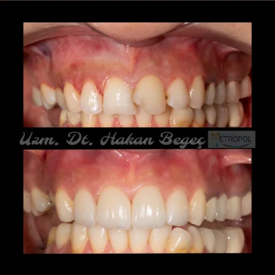 vakalarımız - mutlu gülüş galerisi