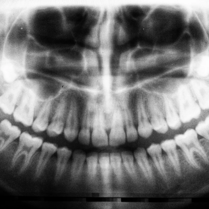 Ağız ve Diş Sağlığı