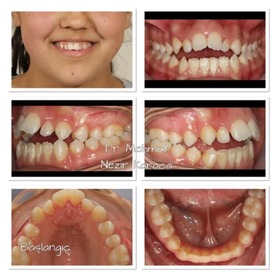 vakalarımız - mutlu gülüş galerisi