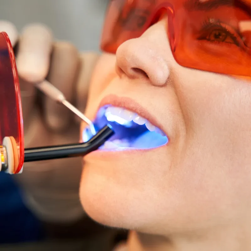 Diyarbakır Estetik Diş Dolgusu