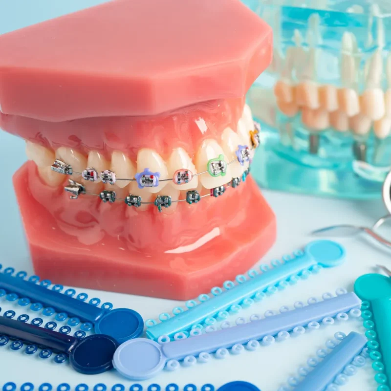 Diyarbakır Ortodontik Tel Tedavisi